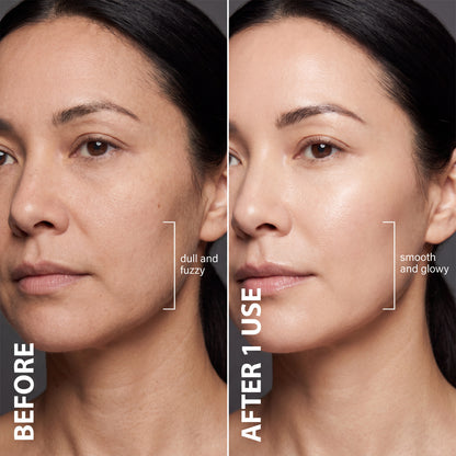 Velour™ Dermaplaning Tool